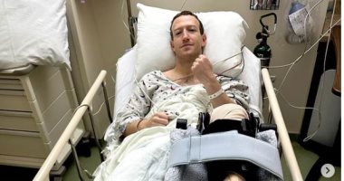 مارك زوكربيرج يخضع لعملية جراحية بسبب إصابة فى الركبة